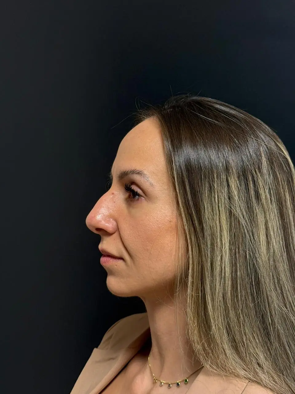 antes (1) antes (1)